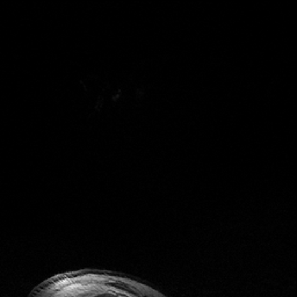 MRI scan